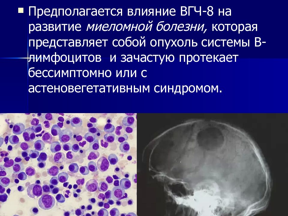 Миеломный градиент. Миеломная болезнь на кт черепа. Рентген черепа при миеломной болезни. Череп при миеломной болезни.