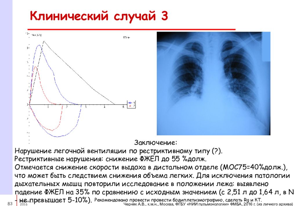 Бронходилатационный тест положительный