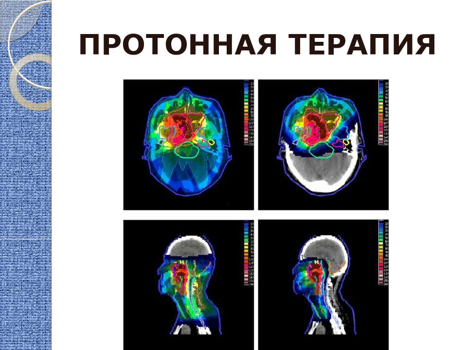 Протонная терапия. Протонная лучевая терапия презентация. Протонная терапия презентация. Протонная терапия схема.