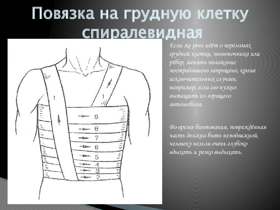 Повязка дезо техника наложения в картинках пошагово