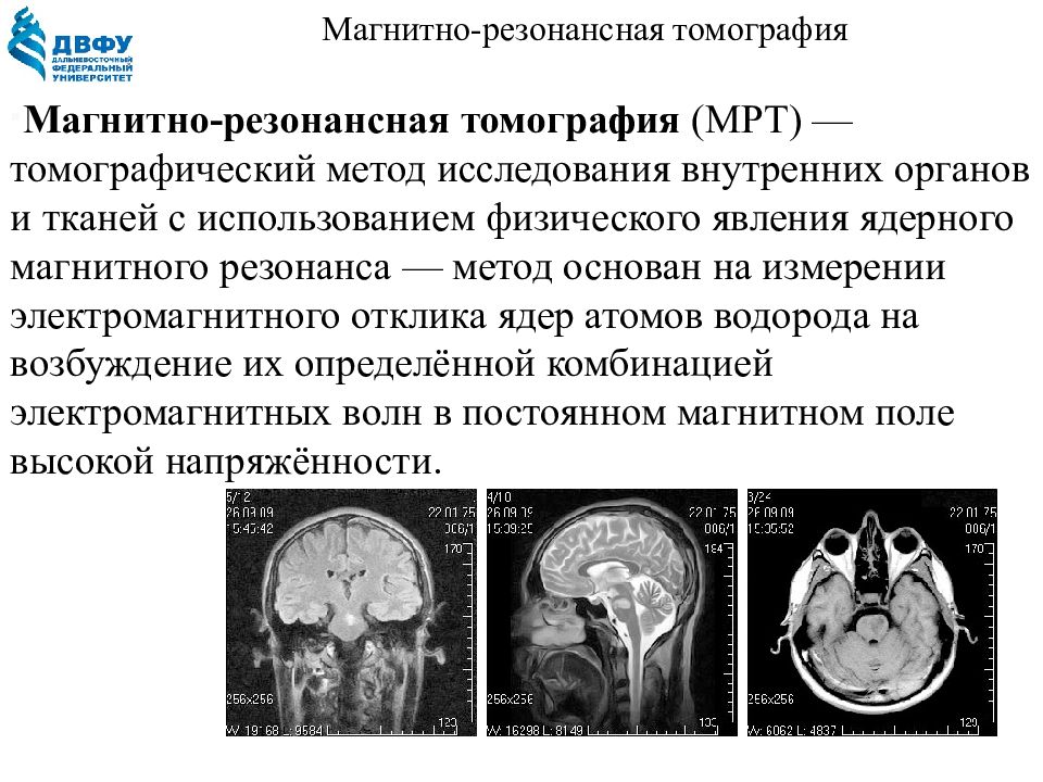 Режимы кт. Магнитно-резонансная томография(мрт) историческая справка. Компьютерная томография режимы. Метод мрт основан на измерении электромагнитного отклика ядер атомов.