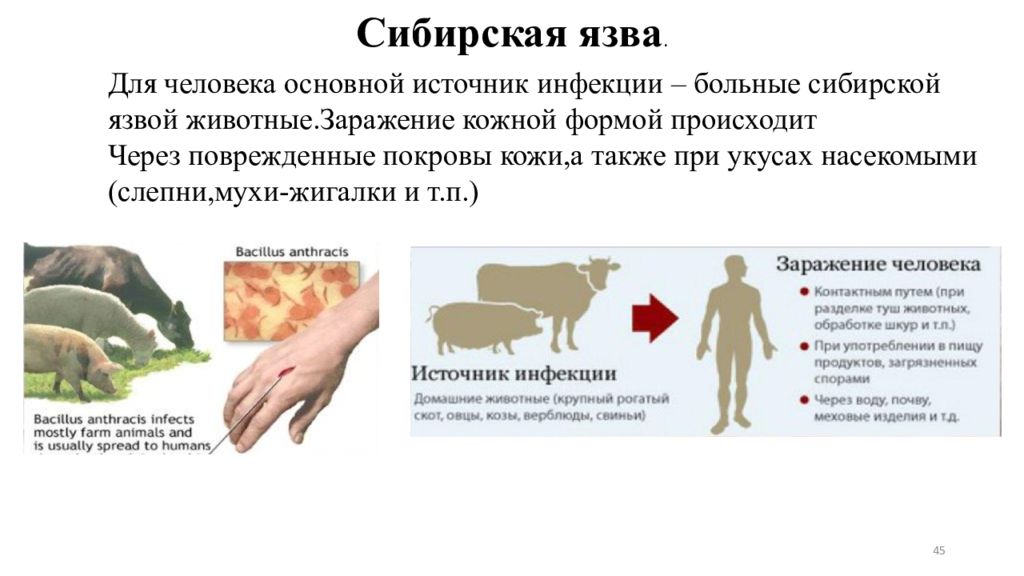 Бруцеллез презентация по микробиологии