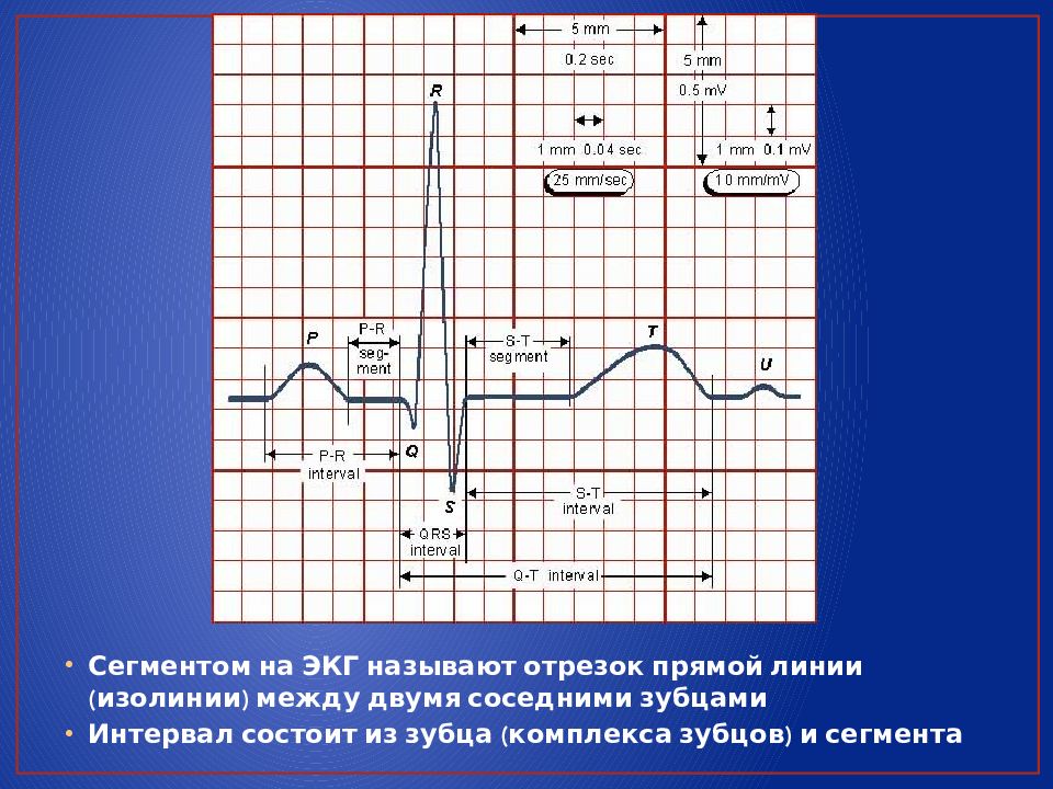 Презентация экг для студентов