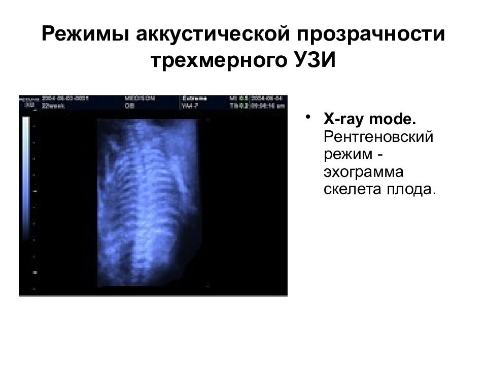 Презентация на тему узи