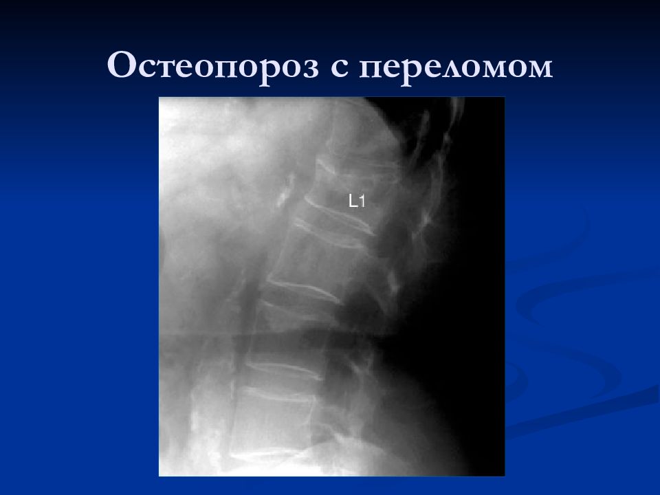 Лучевая диагностика позвоночник презентация