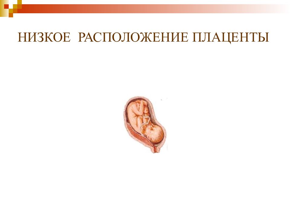 Низко лежит. Низкие расположение поаценты. Низкое расположение плаценты. Плацента низко расположена. Нормальное расположение плаценты.