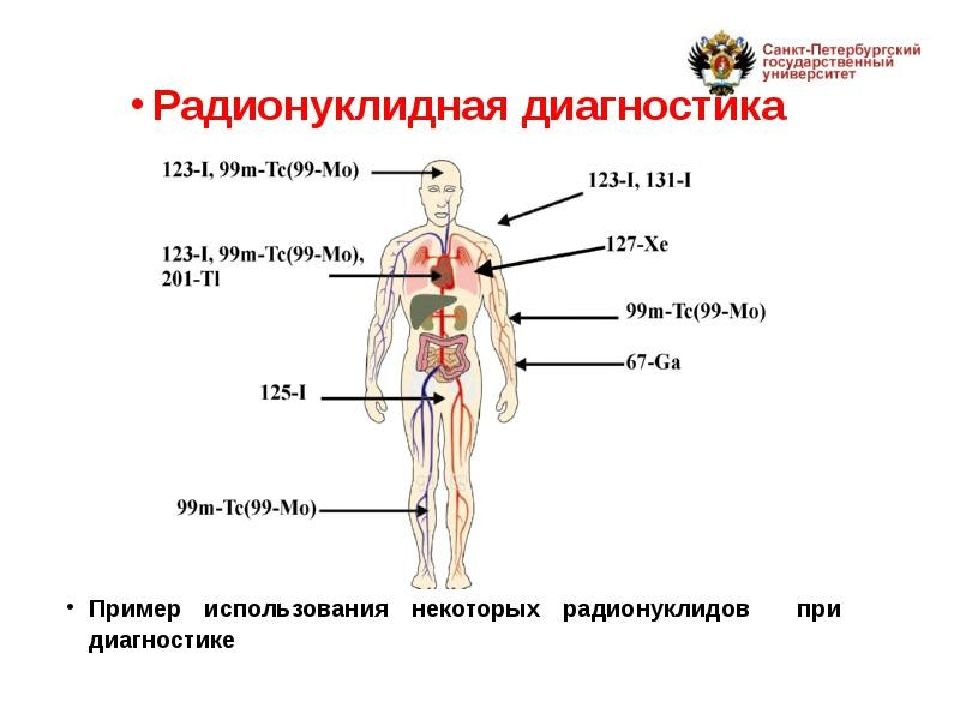 Радионуклидная диагностика. Схема радионуклидной диагностики. Физические основы радионуклидной диагностики. Схема методов радионуклидной диагностики.