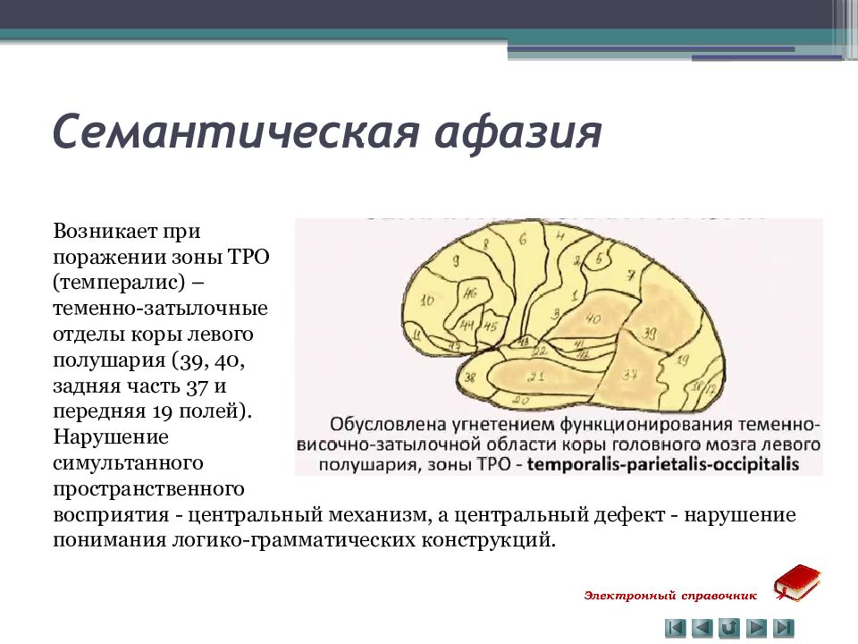 Афазии локализации поражения. Семантическая афазия зона поражения. Сенсорная афазия зона поражения по Бродману. Семантическая афазия возникает при поражении. Семантическая афазия локализация поражения.