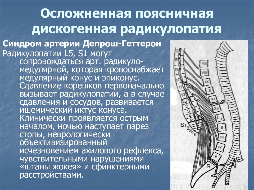 Радикулоишемия