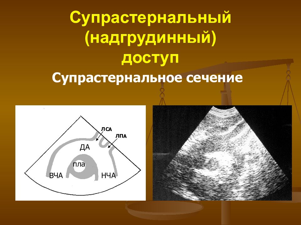 Узи сердца презентация