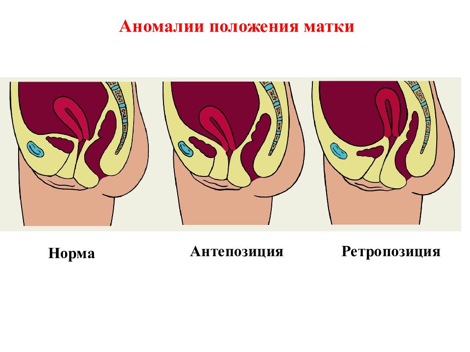 Матка в норме