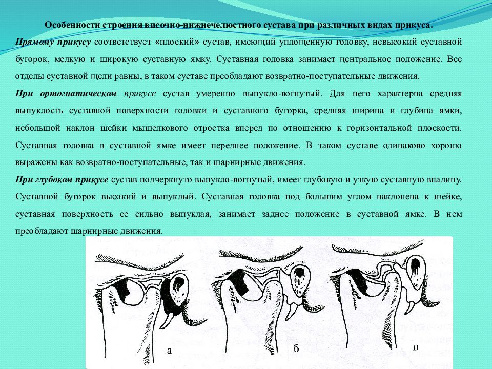 Внчс это. Анатомическое строение височно-нижнечелюстного сустава (ВНЧС).. Строение ВНЧС схема. Элементы, образующие височно-нижнечелюстной сустав. Суставная щель ВНЧС.