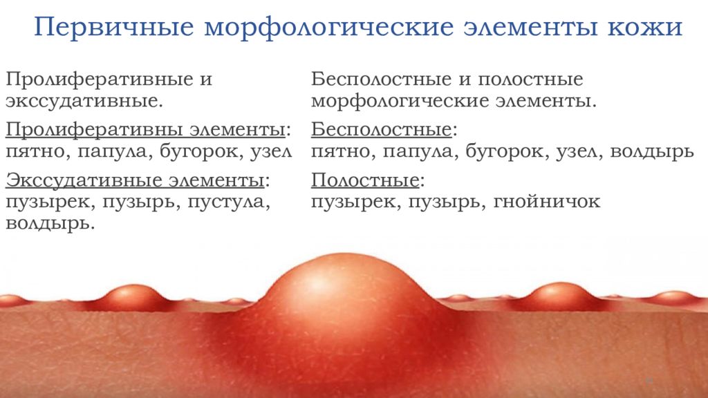 Пятно элемент сыпи. Первичные бесполостные морфологические элементы кожи. Первичный морфологический элемент дерматология. Морфологические элементы кожи папула. Папула первичный морфологический элемент.