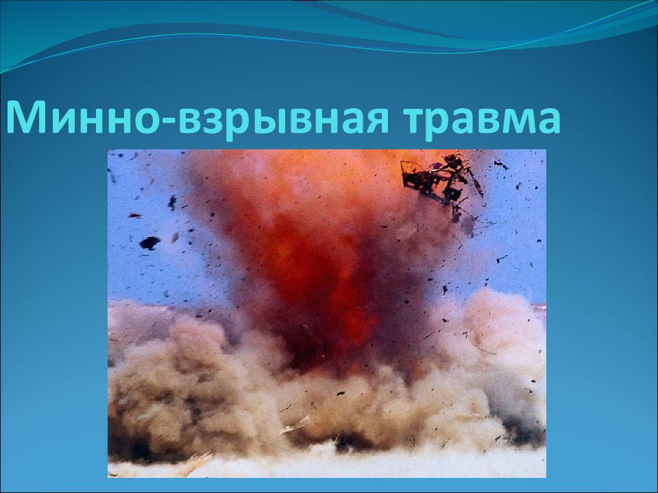 Минно-взрывная травма