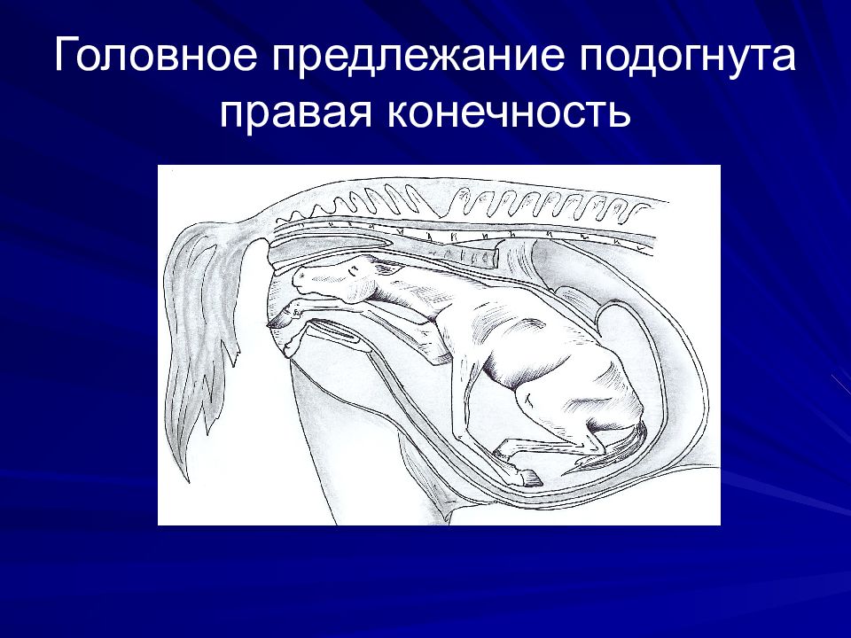 Презентация диагностика беременности акушерство