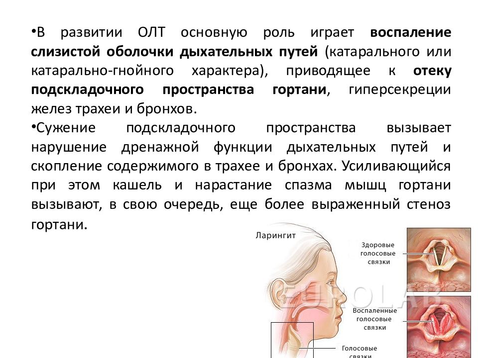 Ларинготрахеит у взрослых. Ларингит трахеит ларинготрахеит. Ларинготрахеит характер кашля. Острый ларинготрахеит симптомы.