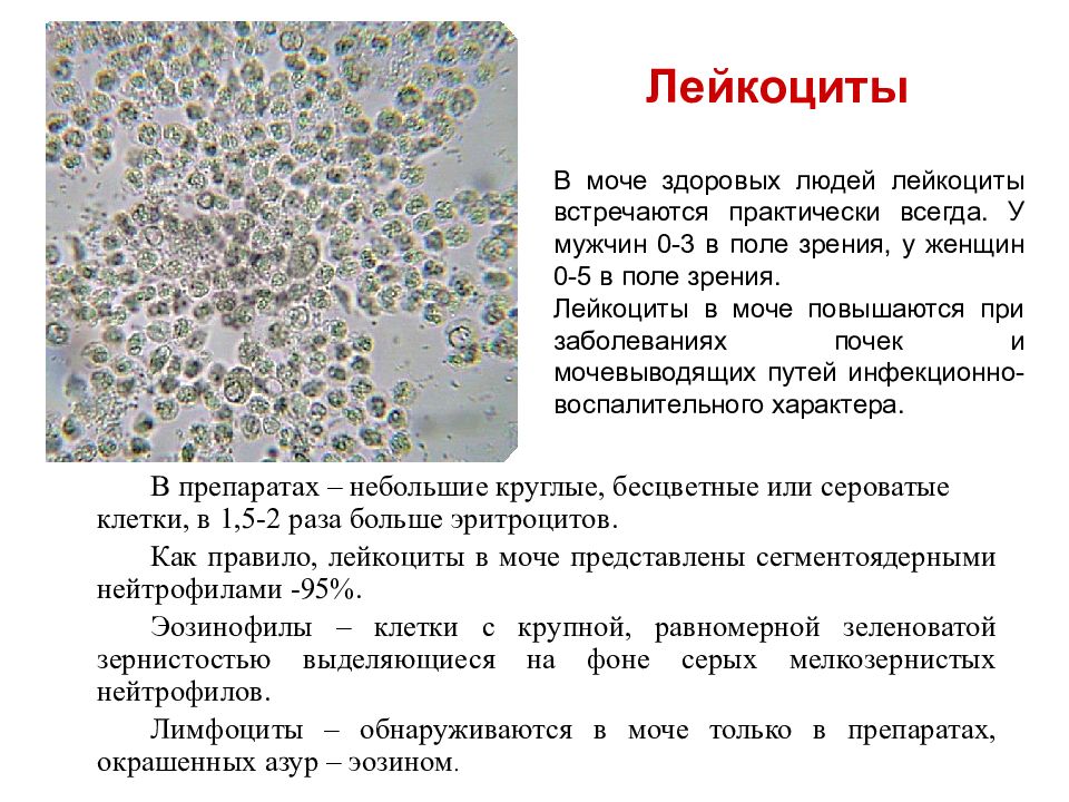 Эритроциты в моче картинки