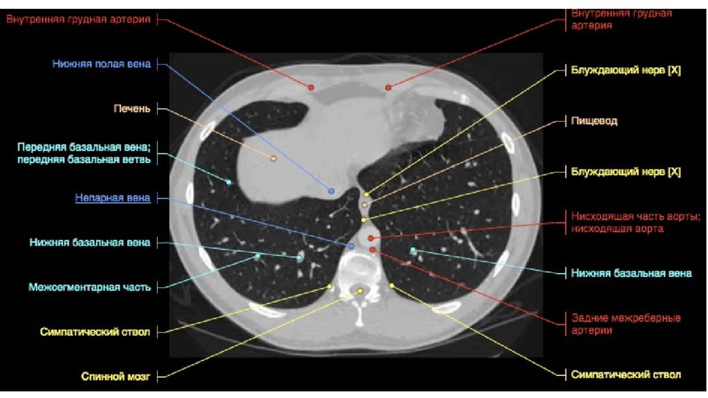 Кт клетки. Кт срезы грудной клетки. Кт анатомия грудной клетки анатомические структуры. Кт органов грудной клетки с обозначениями. Кт анатомия органов грудной клетки.