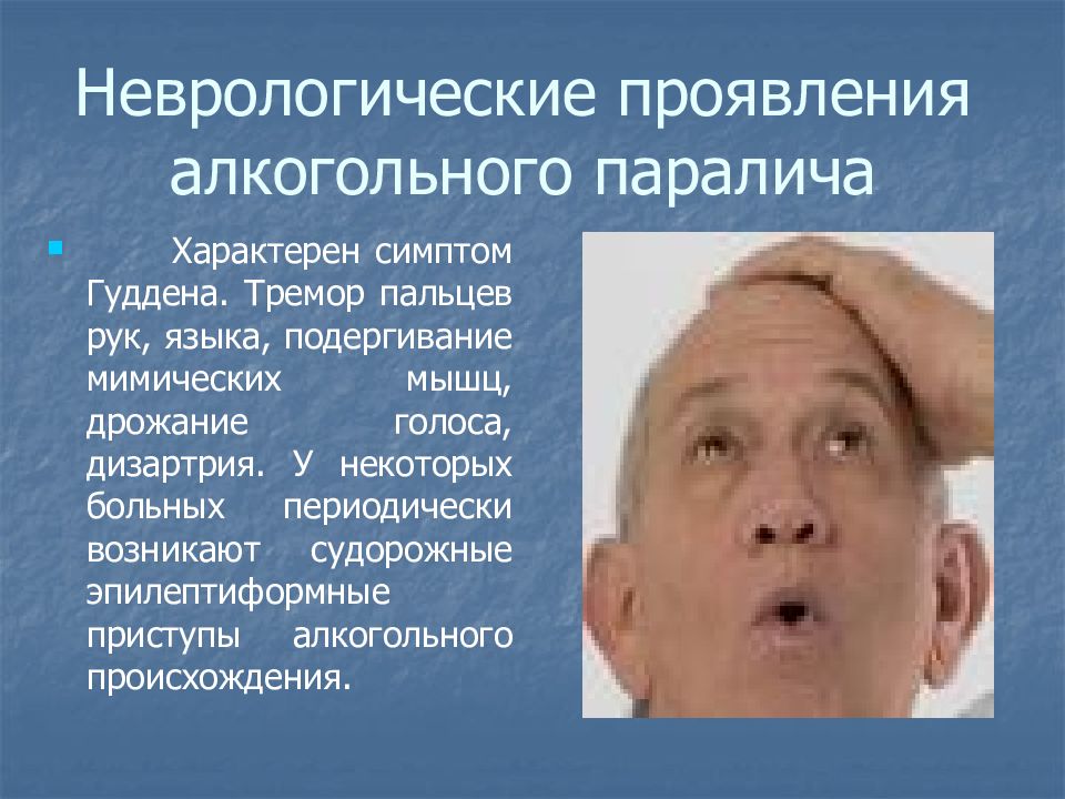 Тремор после. Симптомы паралича. Неврологический паралич. Алкогольный паралич симптомы.