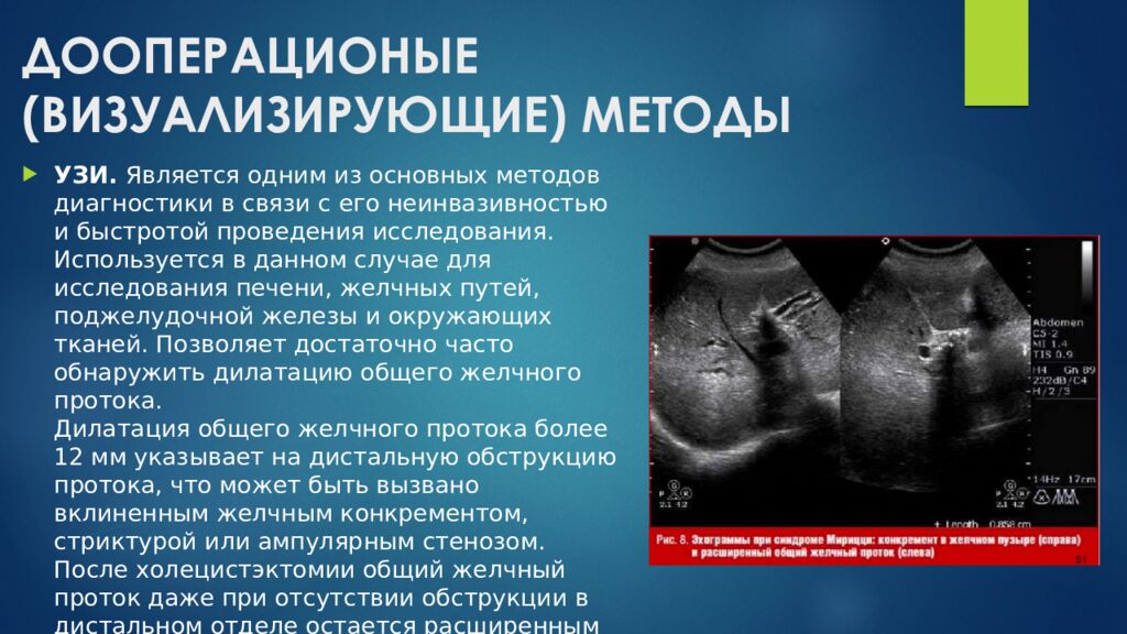 ДООПЕРАЦИОНЫЕ (ВИЗУАЛИЗИРУЮЩИЕ) МЕТОДЫ