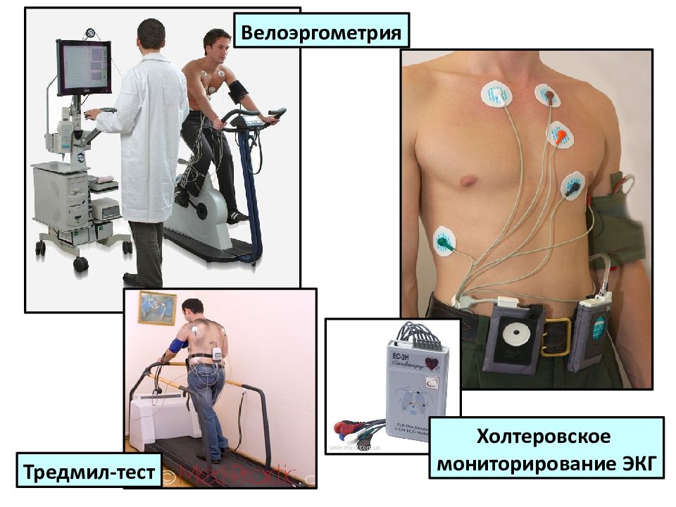 Велоэргометрия. Холтеровское мониторирование стенокардия. Холтеровское мониторирование, ВЭМ. Стенокардия велоэргометрия. Велоэргометрия электроды.