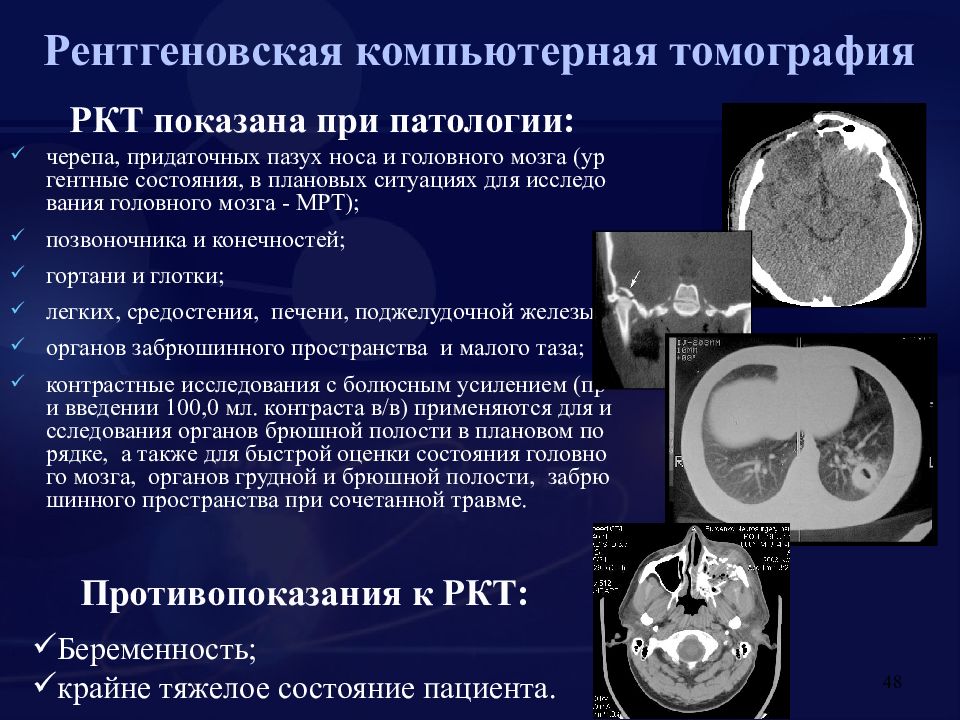 Насколько вредно кт. Преимущества РКТ при исследовании органов грудной полости.. Рентгеновская компьютерная томография. Рентгеновская компьютерная томография (РКТ). Понятие о компьютерной томографии.