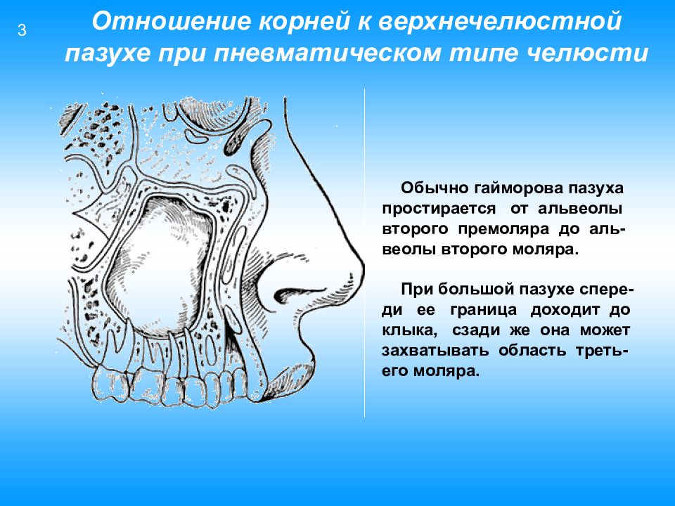 Правая верхнечелюстная пазуха где находится картинка