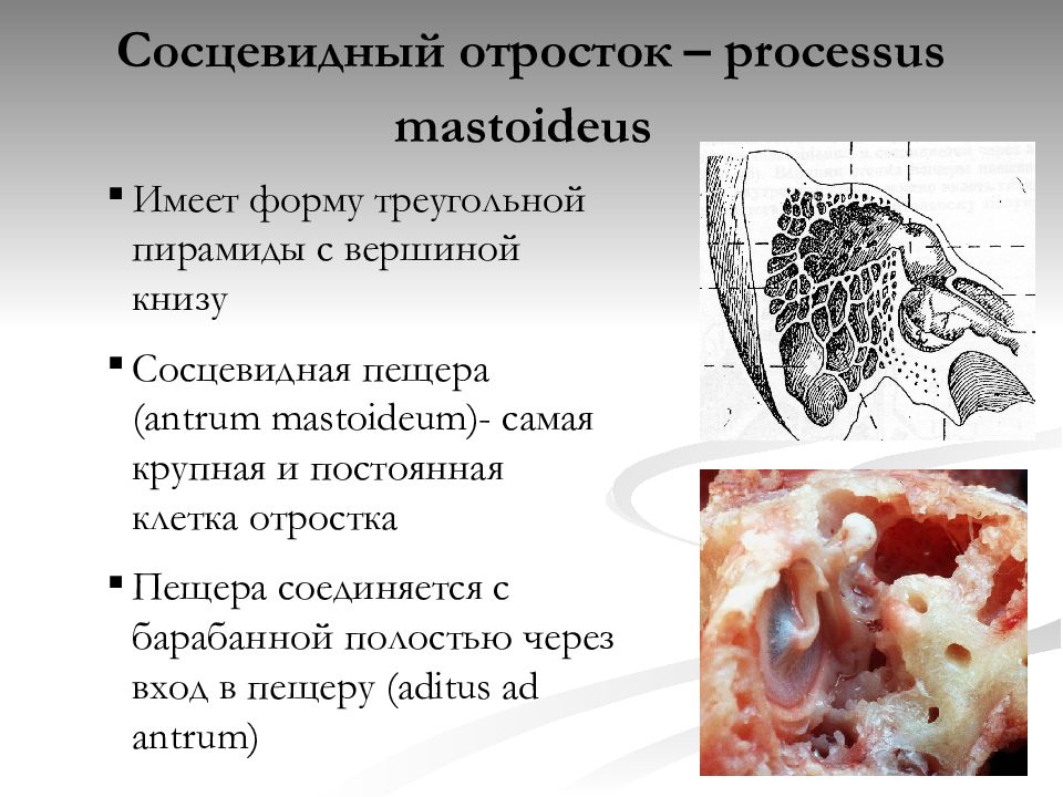 Стенки сосцевидного отростка