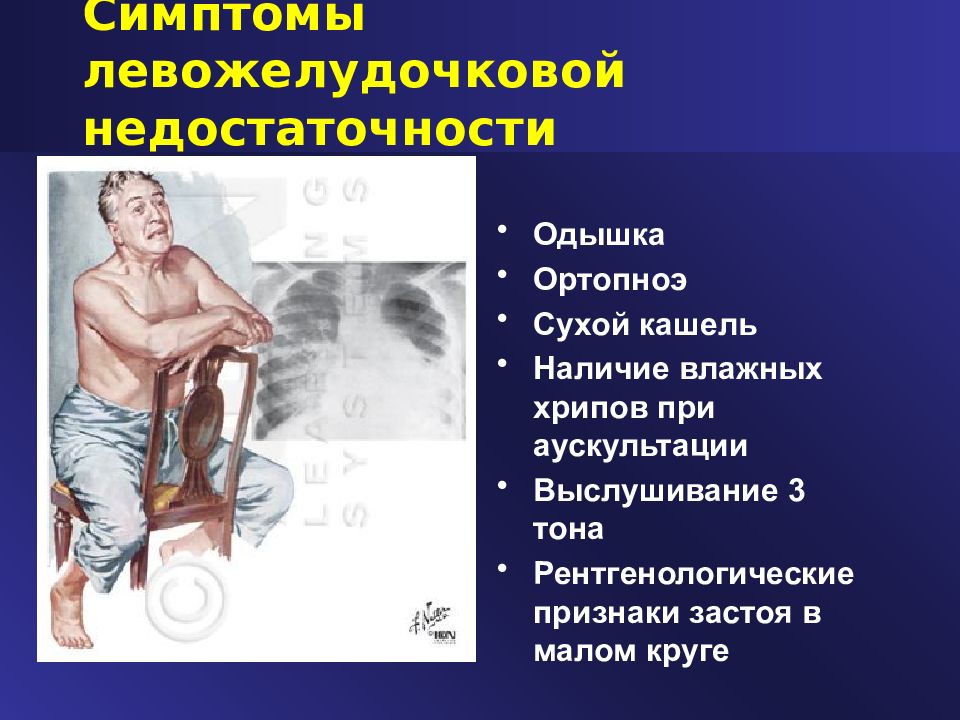 положение ортопноэ это