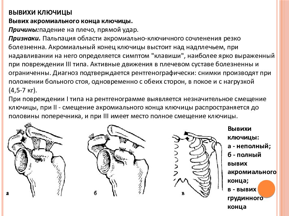 Повреждения плечевого пояса презентация