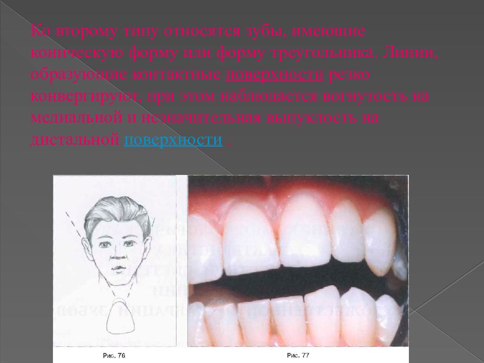 Виды окклюзии в стоматологии презентация