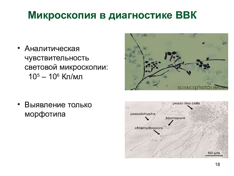 Микроскопия алгоритм. Микроскопия. Морфотипы микроскопия. Микроскопия количество микроорганизмов. Какие бактерии дают температуру.