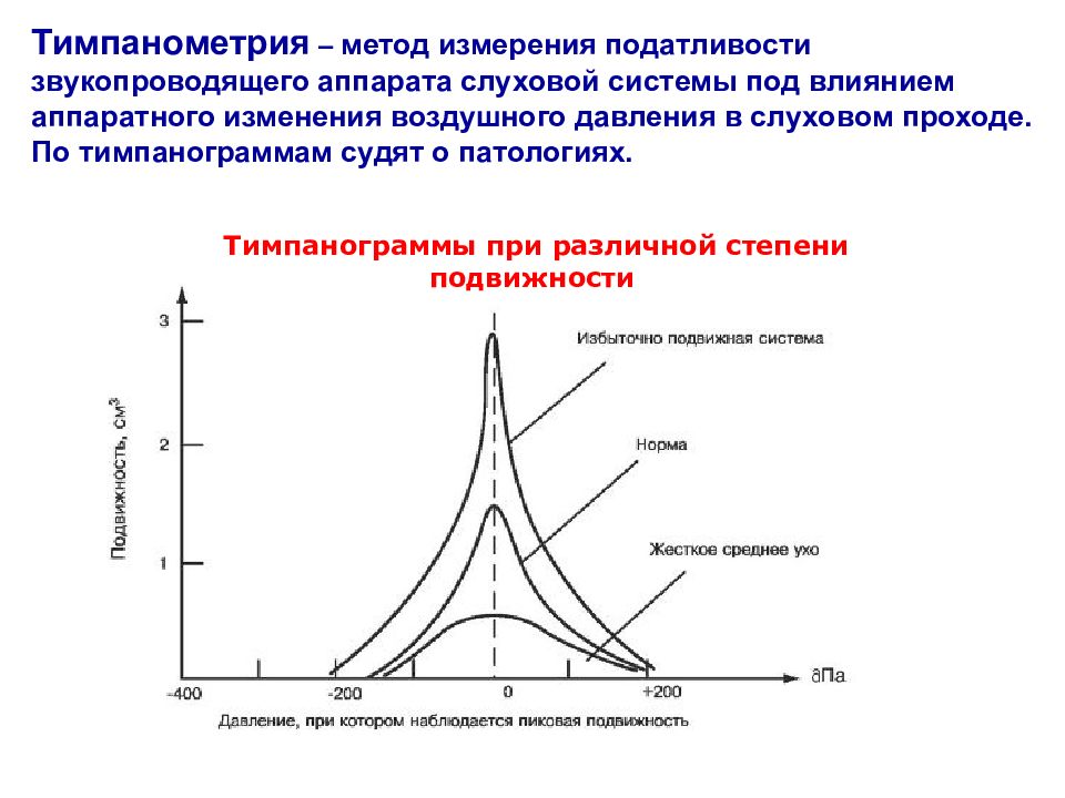 Типы тимпанограмм