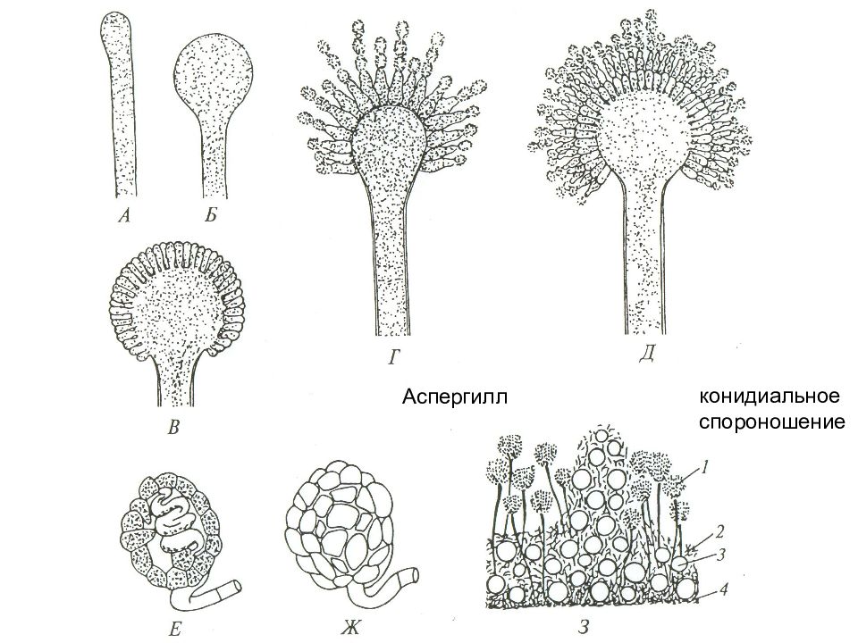 Спороношение это. Строение грибов аспергилл. Аспергилл гриб строение. Конидии аспергилла. Анаморфа аспергилла.