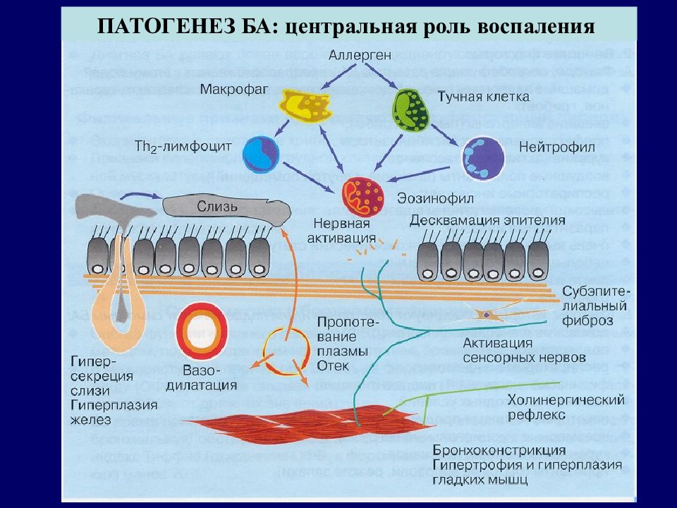 Схема патогенеза бронхиальной астмы