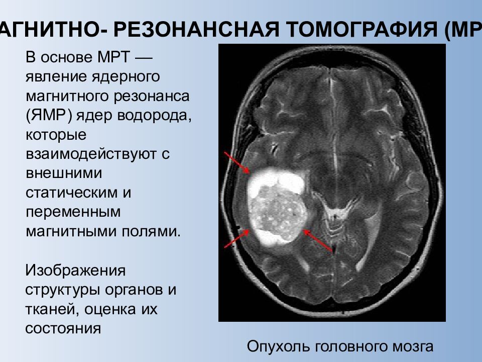 Мрт методика получения изображения