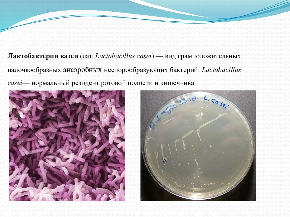 Lactobacillus para que sirve