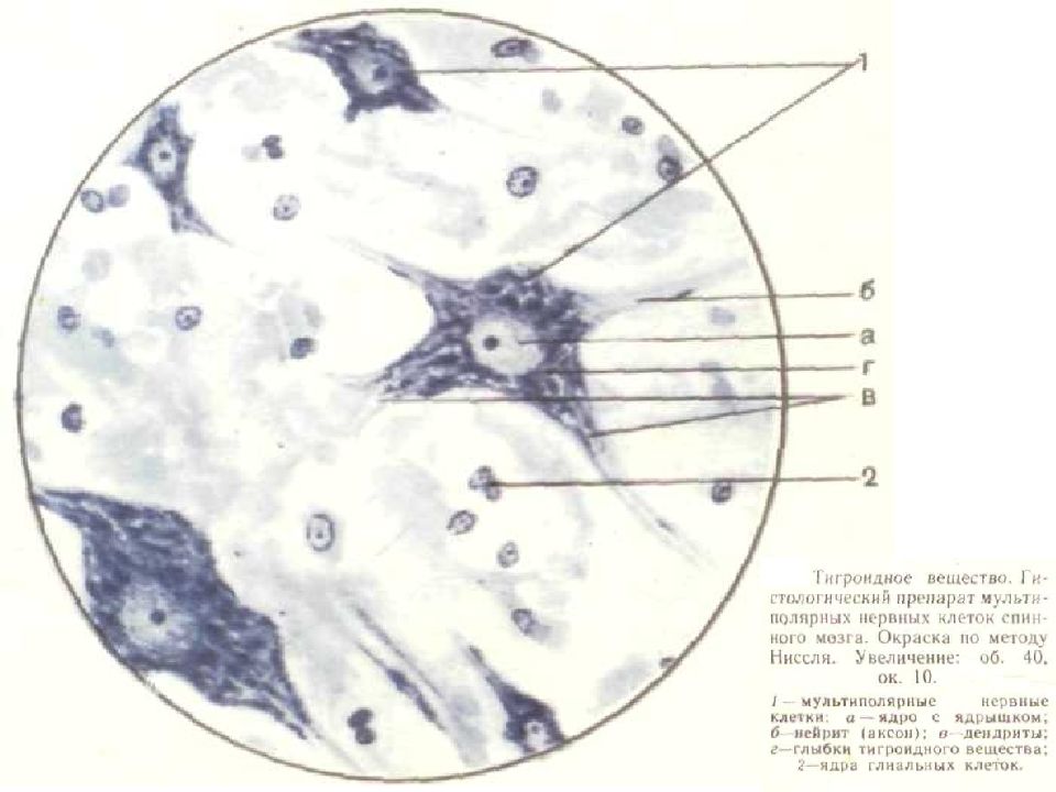 Нервная ткань гистология. Нервные клетки гистология препарат. Нервная ткань Тигроид гистология препараты. Тигроид в нервных клетках спинного мозга препарат. Нейрофибриллы в клетках спинного мозга препарат.