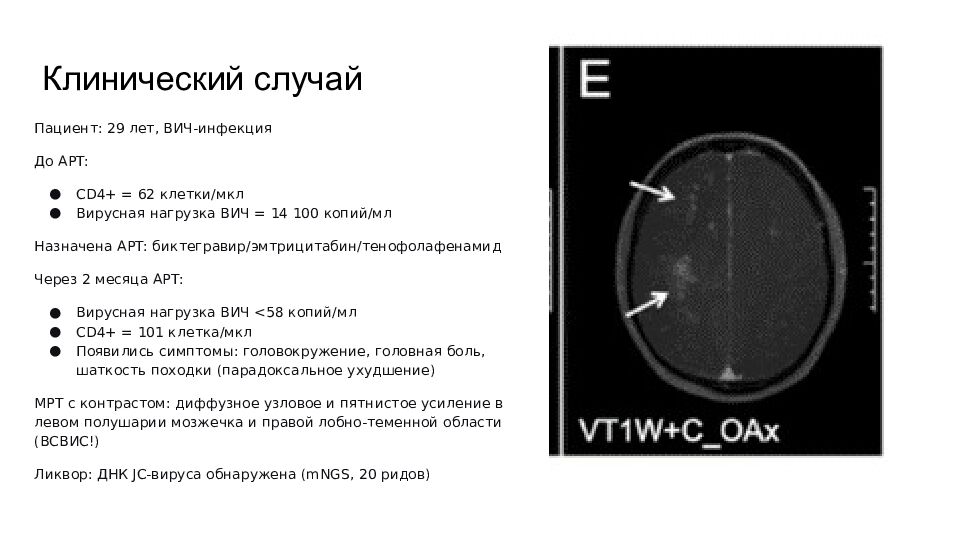 Клинический случай