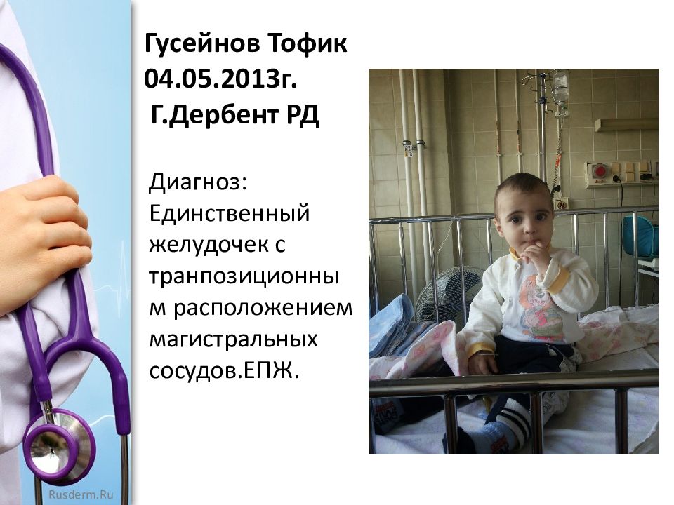 Сколько Лет Живут Люди С Впс