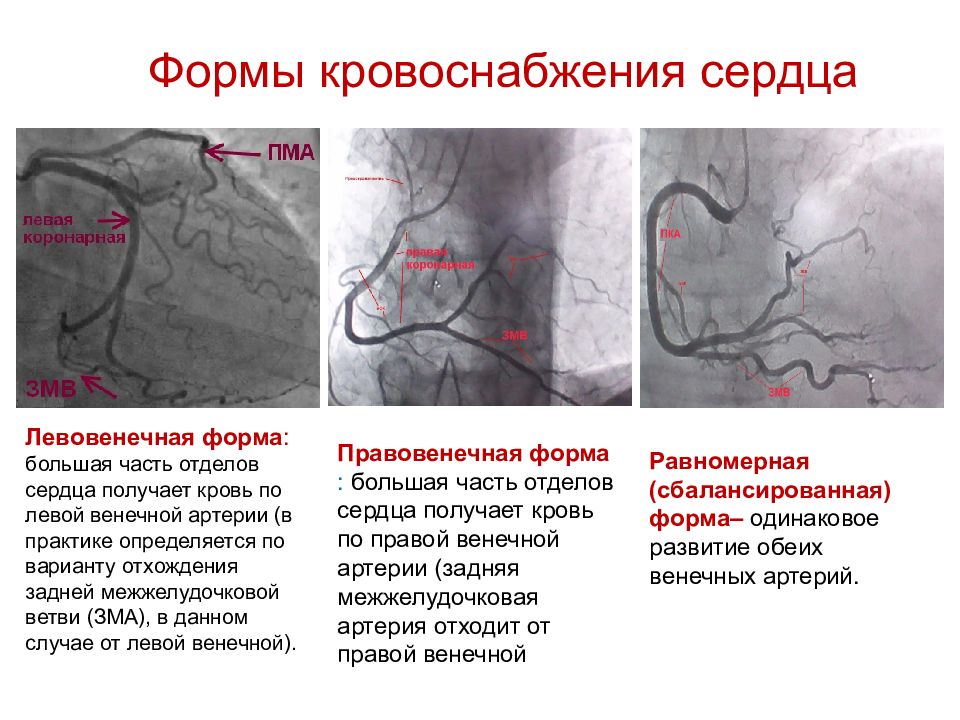 Сосуды сердца схема коронарография