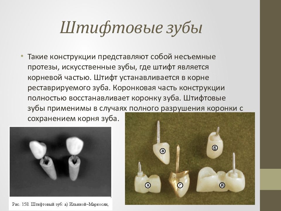 Штифтовые конструкции в ортопедической стоматологии презентация