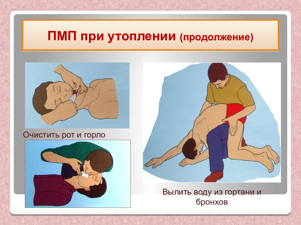 Презентация первая помощь при утоплении остановке сердца и коме