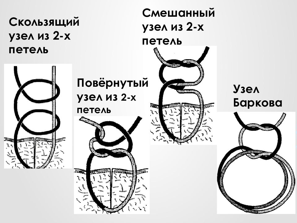 Хирургический узел схема