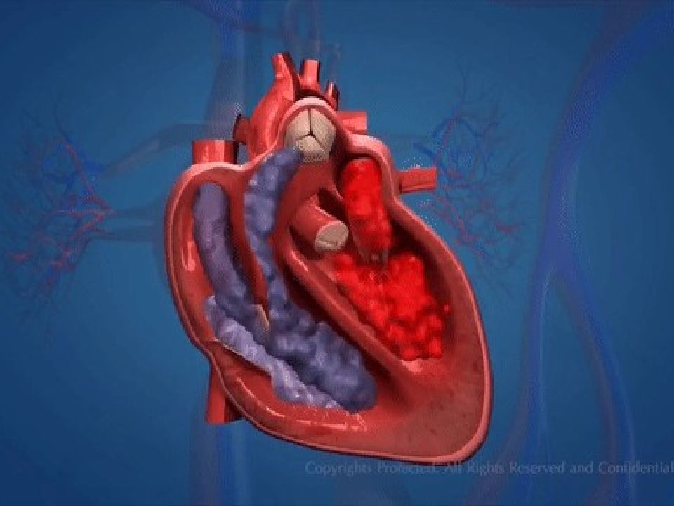 Katta va kichik qon aylanish doirasi Katta va kichik qon aylanish doirasi