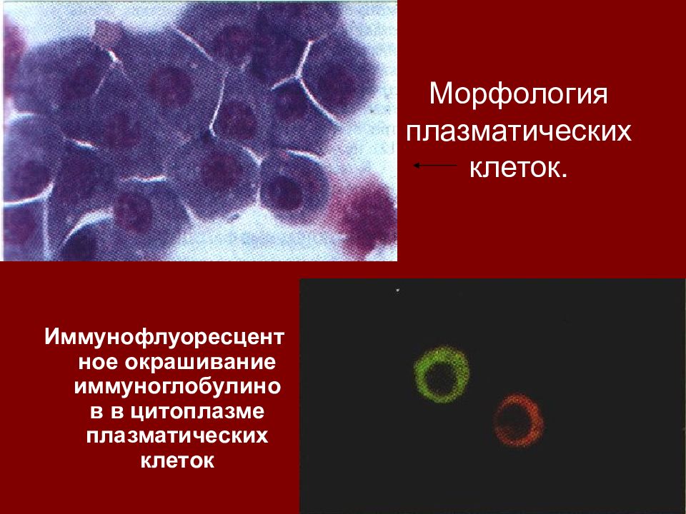1 плазматическая клетка. Плазматические клетки плазмоциты. Морфология плазматической клетки крови. Морфология плазматических клеток. Плазматические клетки иммунной системы.