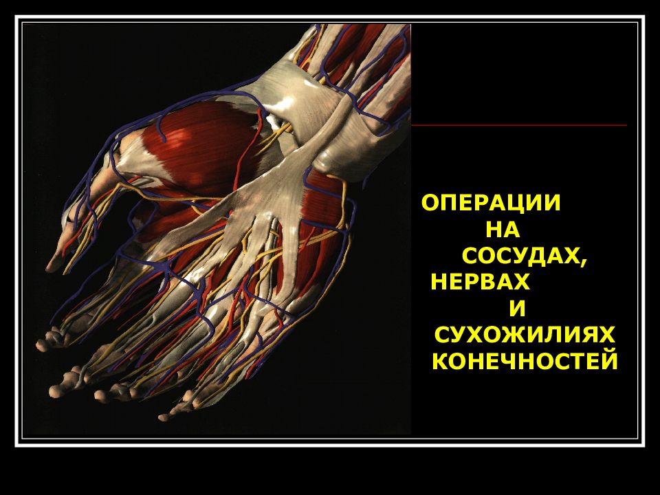 Презентация операции на сухожилиях