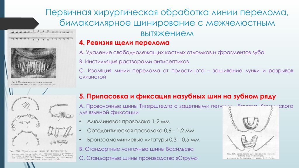 Методы временной и постоянной иммобилизации отломков челюстей презентация