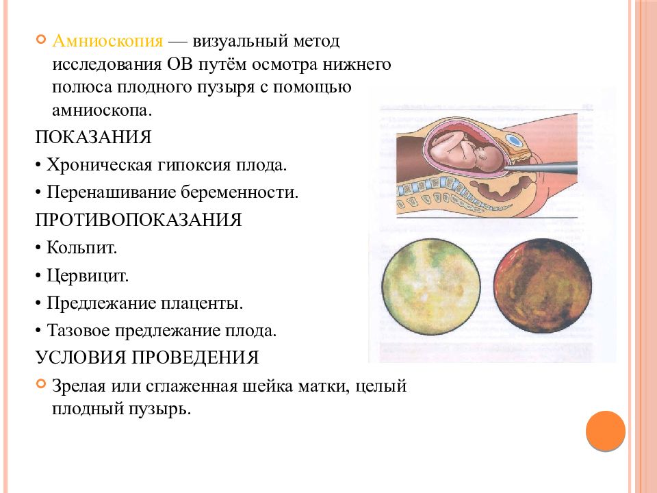 Диагностика беременных презентация