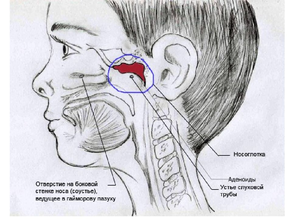 Схема горло ухо нос